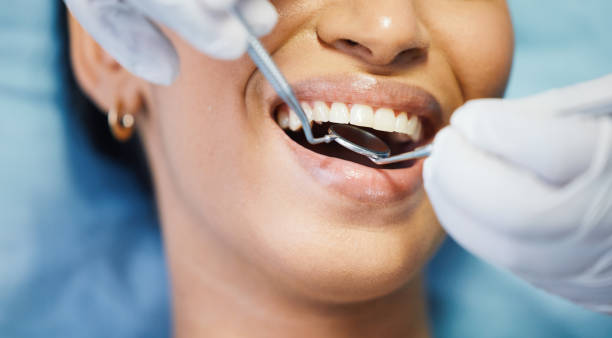 Best Emergency Broken Tooth Repair in Helena Flats, MT
